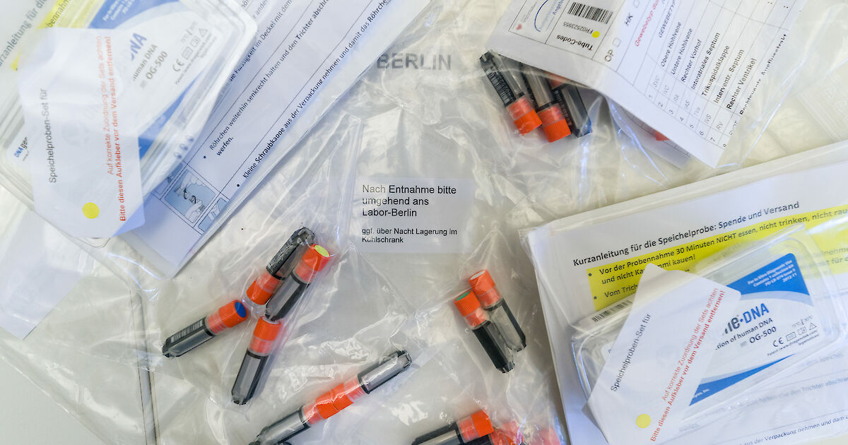 DNA-Proben bestätigen Wolfsrisse im Nordburgenland DNA-Proben bestätigen Wolfsrisse im Nordburgenland